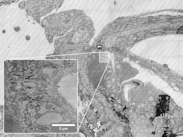 FAST-EM | Ultra-fast automated multibeam electron microscope