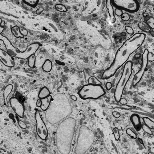 Electron micrographs of songbird brain in neuroscience