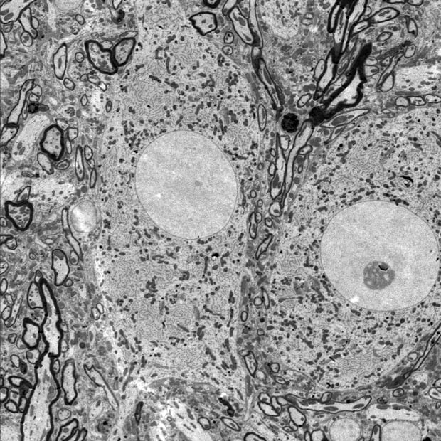 Electron micrographs of songbird brain in neuroscience