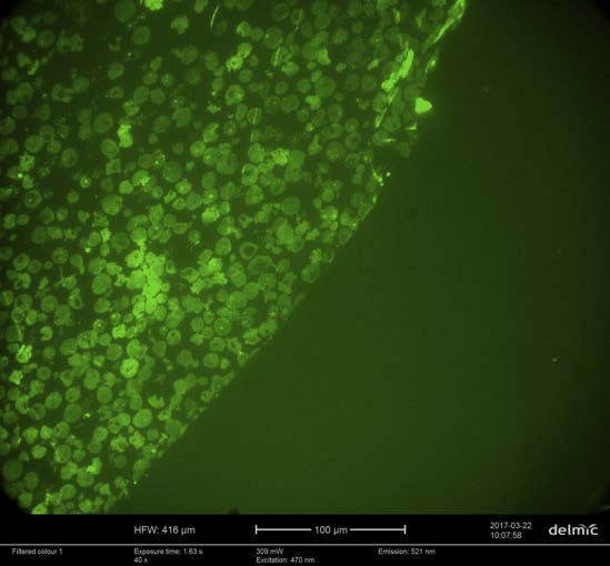 Fluorescence image of a 100 nm thick ultra-thin section containing whole infected cells acquired using a low magnifica-tion (40X) air objective lens on the SECOM. The sections was mounted on an ITO/glass coverslip and imaged with an excitation wavelength of 467 nm (false colour). Sa