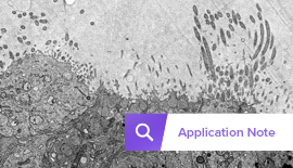 Accelerate and deepen the insight into infectious disease with FAST-EM