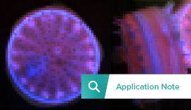 Cathodoluminescence on unicellular marine organisms