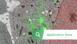 Cellular Biology: In-resin Fluorescence Using GFP and mCherry