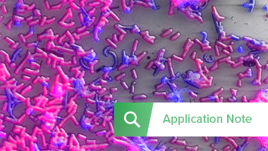 Image Thumbnail Application note CLEM Marine MicrobiologyRES_380x215