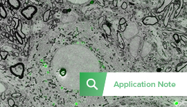 Neuroscience: Synaptic Connectivity in the Songbird Brain