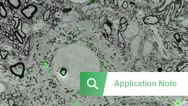 Image Thumbnail Application note CLEM NeuroscienceRES_380x215
