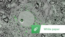https://request.delmic.com/hubfs/Website%20Content%20Offers/CLEM%20White%20Papers/Thumbnails%20White%20Paper%20CLEM/Image%20Thumbnail%20White%20paper%20CLEM%20Sample%20preparationRES_270x153.jpg
