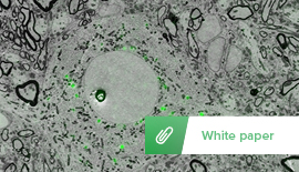 Sample Preparation for Correlative Light and Electron Microscopy