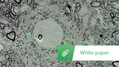 Image Thumbnail White paper CLEM Sample preparationRES_380x215