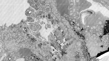 High-resolution multi-organ nanoimaging of zebrafish with FAST-EM