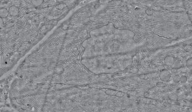 20200213_Fast-Imaging blogpost-01