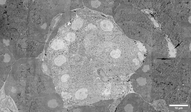 20200615 Blog post Fast EM pancreas