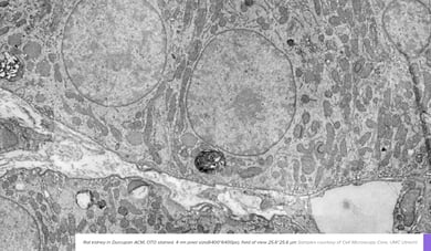 2021_FI_Banner_RatKidney_Website