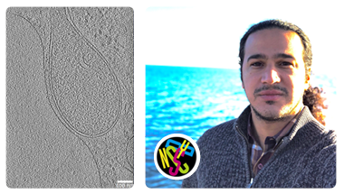 How New York Structural Biology Center increased their lamellae production 3x without compromising the workflow