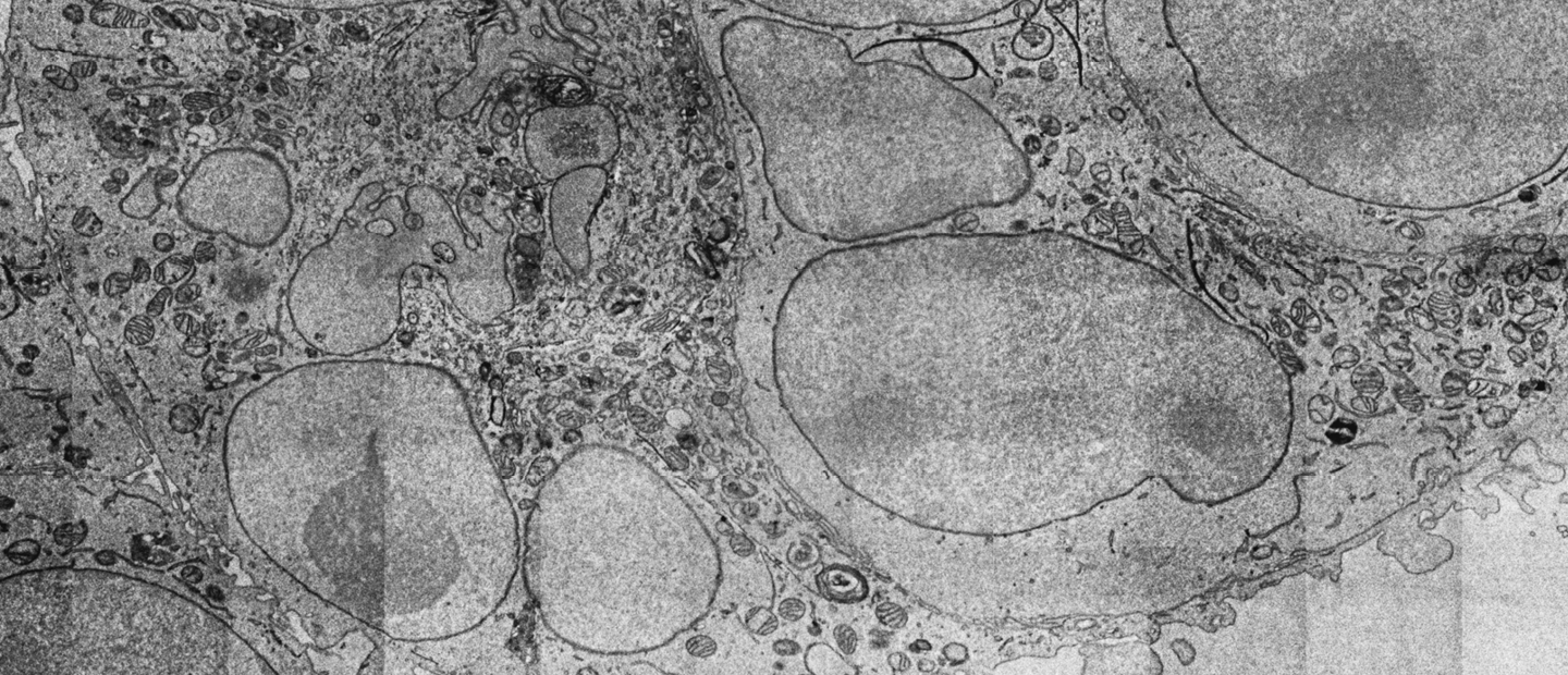 Cancer_FI_Media with Description