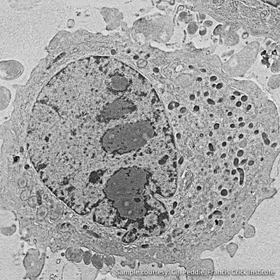 Correlative-light-electron-microscopy-figure3