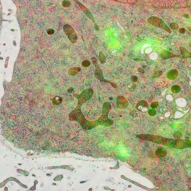 correlative light electron microscope image of hela cancer cell