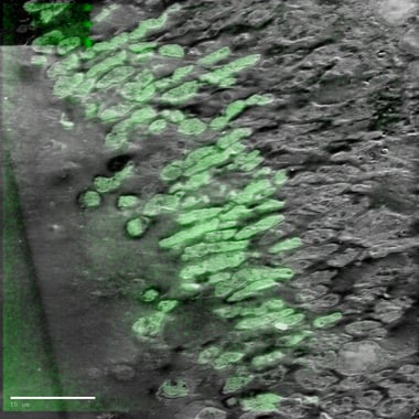 Thin section of mouse intenstine. 