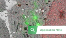 https://request.delmic.com/hubfs/Website/Landing%20and%20Thank%20you%20Pages%20Thumbnails/Thumbnail%20SECOM%20Application%20note%20Cellulary%20Biology.png