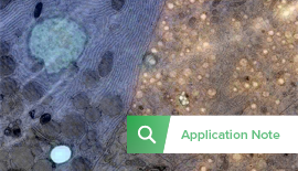 Thumbnail SECOM Application note Type 1 Diabetes