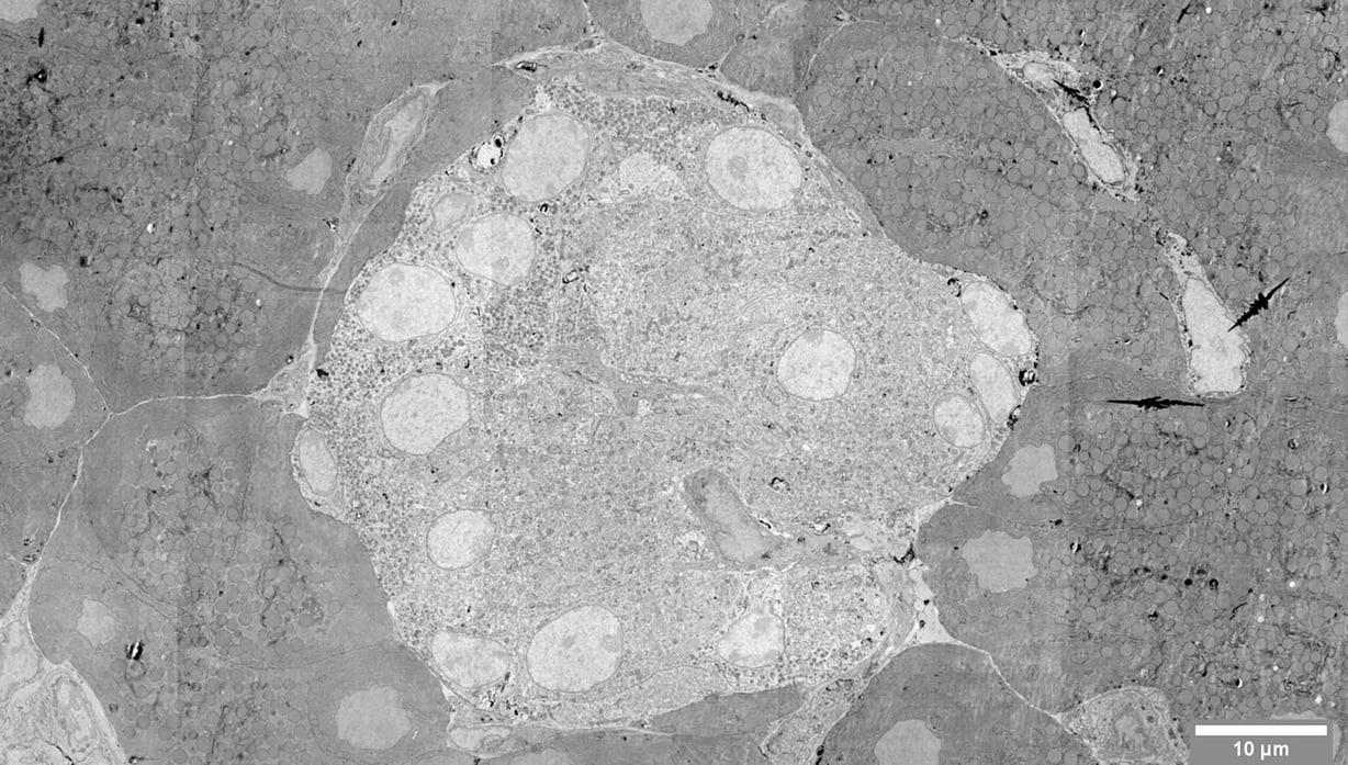 Islet of Langerhans imaged with FAST-EM
