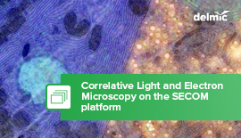 What is Correlative Light and Electron Microscopy?