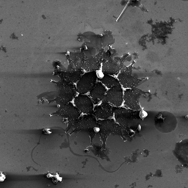 EM image of round Dolichospermum (aka Anabaena) and Aphanizomenon together with dinoflagellates and a diatom