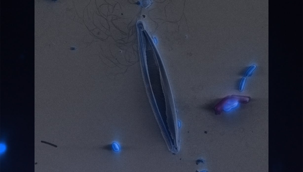 20150904-120045_AF_Dapi_Diatom.ome_RES