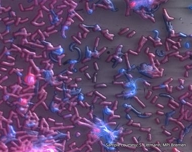  correlative light electron microscope image of marine bacteria
