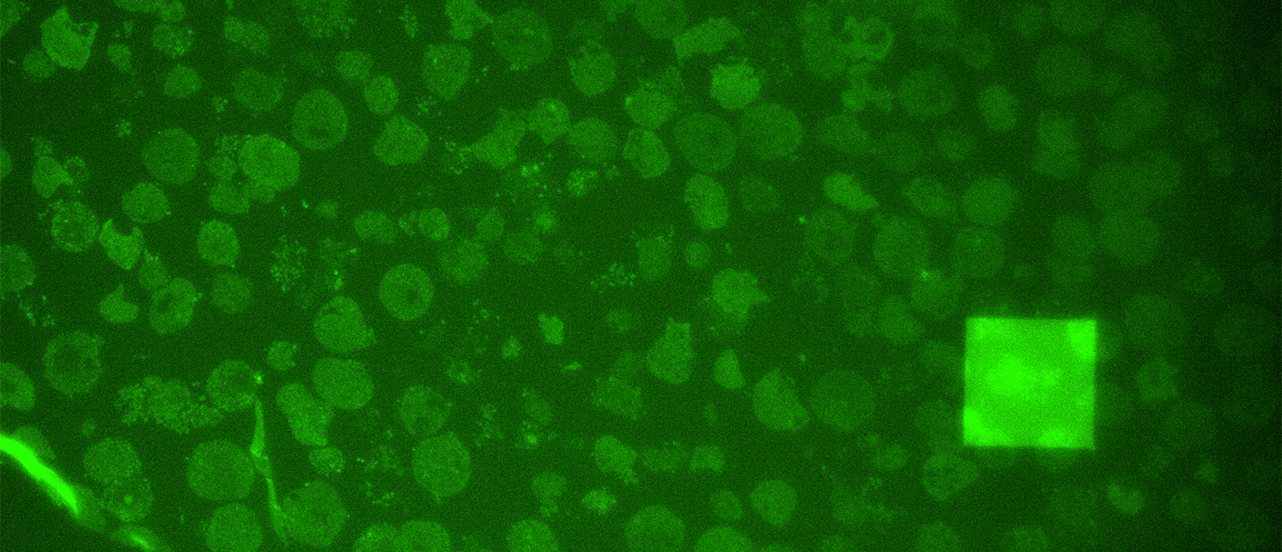 Header an integrated CLEM image showing Tupanvirus-infected amoeba cells
