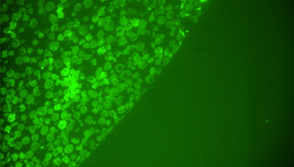 Wide field fluorescence image of a 100 nm thick ultra-thin section of Tupan-virus containing cells