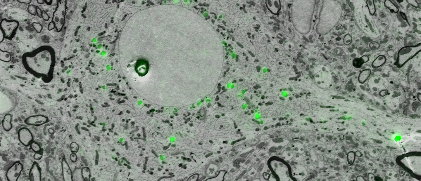 Electron micrographs of songbird brain in neuroscience