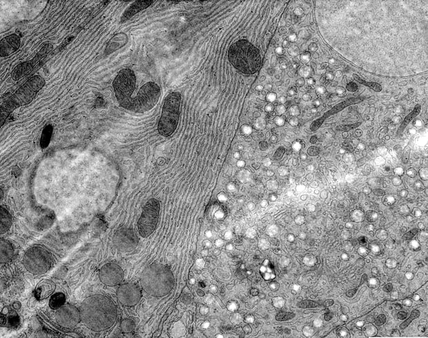 EM image of the islets of Langerhans of Rat Pancreas