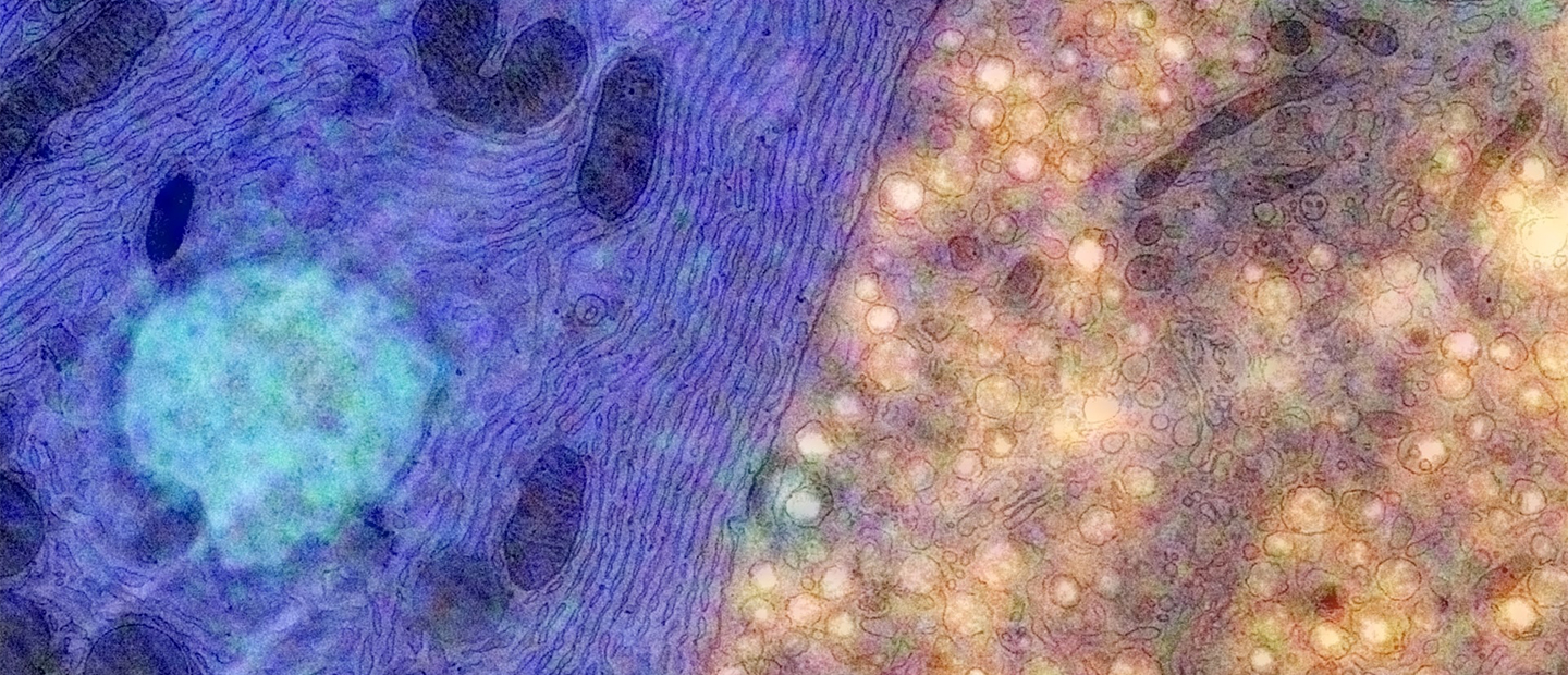 20151208-162429_fig4_FMEM_RES