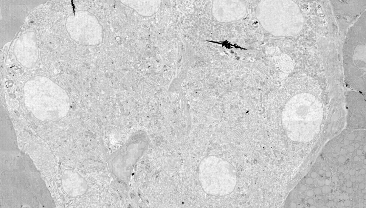 Field image of rat pancreas showing an islet of Langerhans (bottom left) and acinar cells (top right)