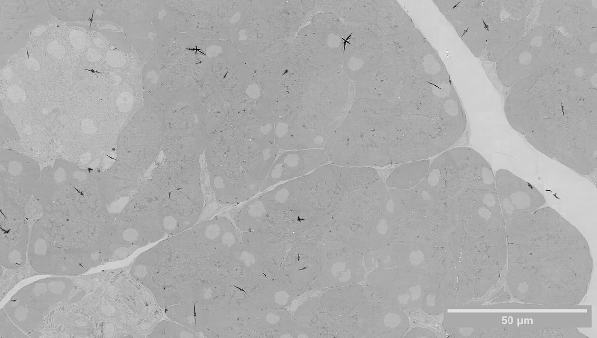 Megafield showing different components of the pancreas, including an islet of Langerhans, acinar cells and ductal cells