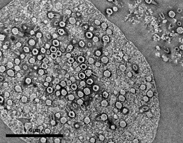 High magnification SEM image of the same section, with no EM stain, showing individual Tupanviruses with the typical capsid and attached tail