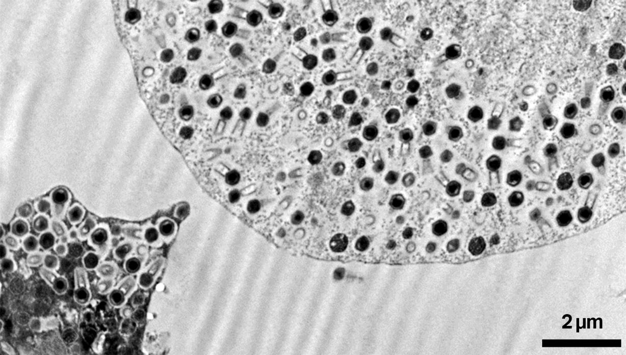 High magnification SEM image of a 100 nm thick ultra-thin section of Tupanvirus particles showing well resolved capsid and tail