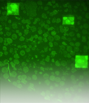 荧光绿色的病毒光电关联图
