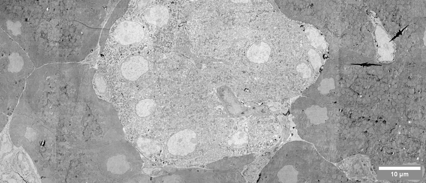 2021_FI_PancreasMegafieldIslet_MediaWithDescription