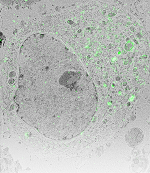 绿白相间的癌症细胞光电关联图