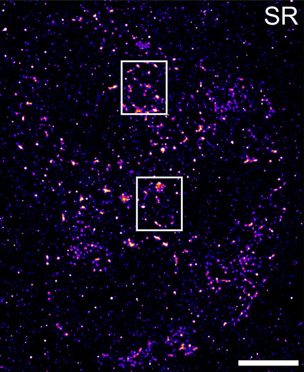 Superresolution image showing localisation of YFP-A3 in a HeLa cell