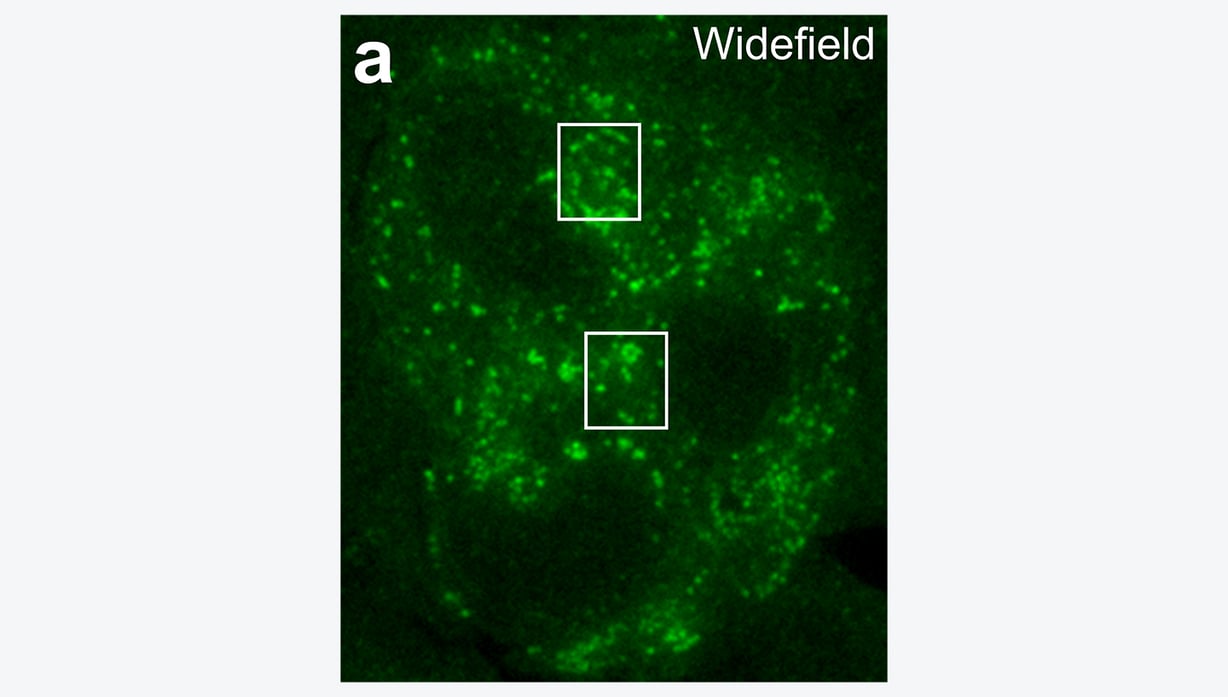 Wide field image showing localisation of YFP-A3 in a HeLa cell