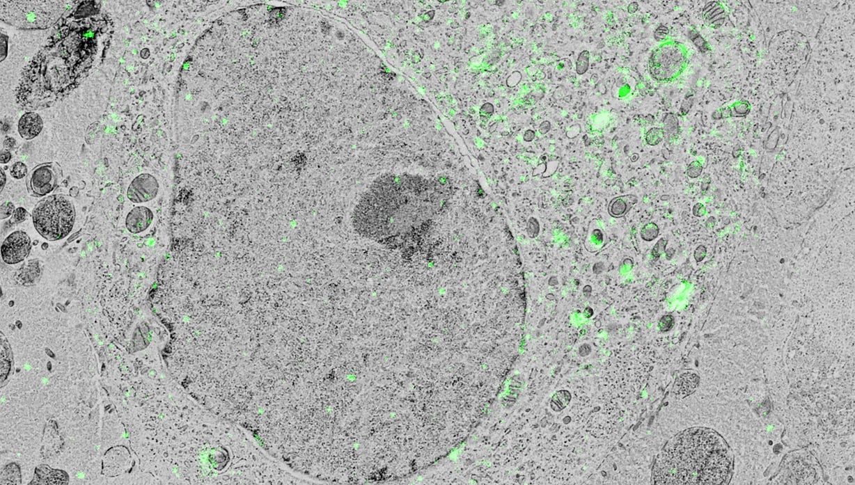 BSE image of an individual cell expressing GFP-C1