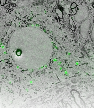 an Integrated CLEM image of a neural cell presenting cell biology Neurosciences