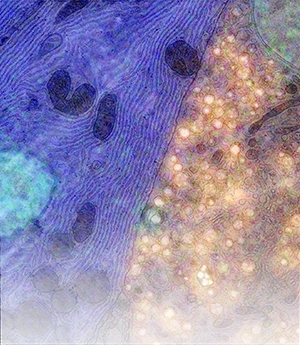 an Integrated CLEM image of a beta cell presenting Type 1 Diabetes