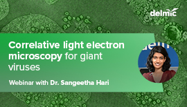 Giant Viruses under correlative light-electron microscopy