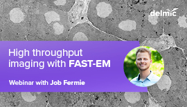 High throughput imaging with Delmic’s new Fast EM system