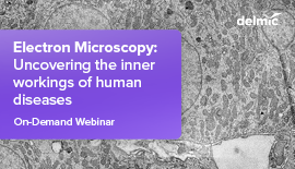 Electron Microscopy: Uncovering the Inner Workings of Human Diseases