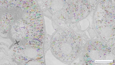 C_Media-Slider_Rat-kidney-mitochondria_scalebar_10um